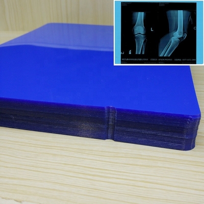 Film medico 11*14In di stampa a getto di inchiostro del film blu del getto di inchiostro ISO9001