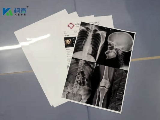 » 180 micron bianchi di ANIMALE DOMESTICO 13X17 X Ray Film Sheets Transparency Film per le stampanti a getto di inchiostro