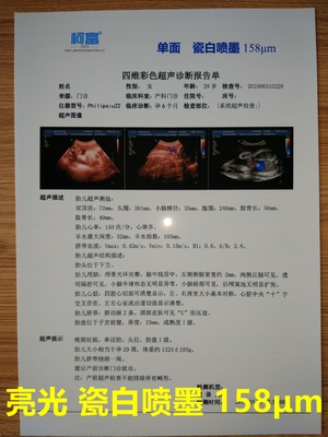 125 micron del film medico opaco basso bianco del getto di inchiostro di CT di film tridimensionale di ricerca