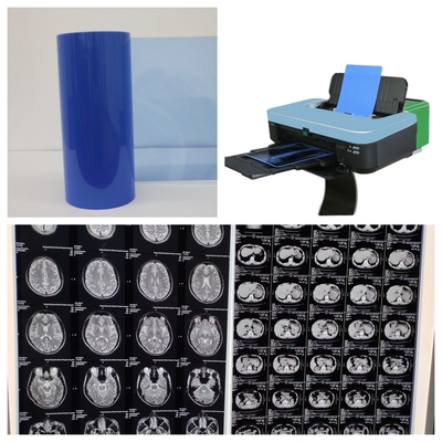 Film a raggi X a getto d'inchiostro da 17 pollici per l'imaging medico 8x10 10x12 11x14 14x17 A4 A3 A3+ 13X17
