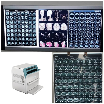 Basso livello X medica Ray Blue Film della nebbia 200±5μM High Sharpness
