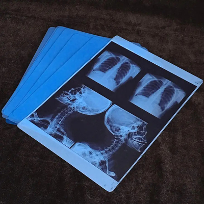8x10 pollici 100 fogli/confezione 10 confezioni/cassetta Film termico per stampa a getto d'inchiostro