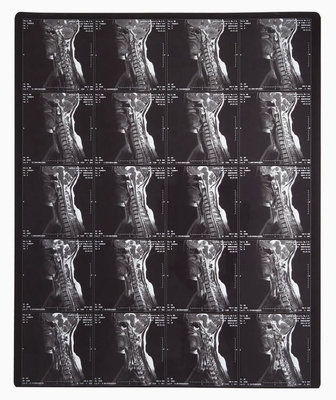 Film laser blu per l'immagine radiologica per stampante di immagini laser a stampa termica