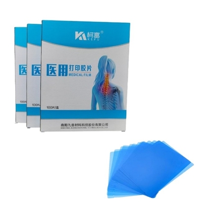 Immagine medica CT DR Tinta a getto Blu Film Medicale Raggi X PET Film A4