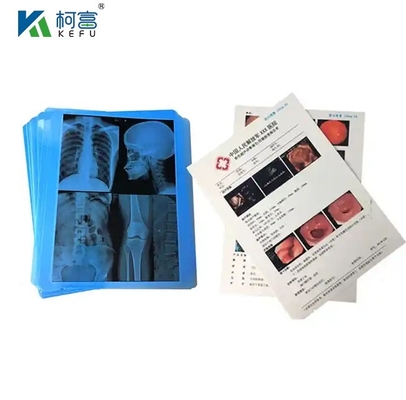 CT Scanner Raggi X asciutti 24x30 Inch Film Inkjet Verde Blu Base Medicale Film a raggi X