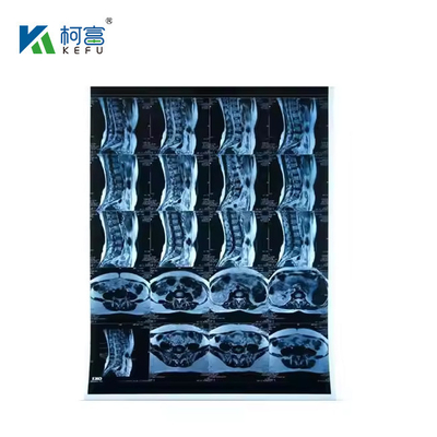 Film blu a getto d'inchiostro medico a raggi X 210micron CT DR Film A4 8x10 Fogli o rotoli per supporti di stampa a getto d'inchiostro medico