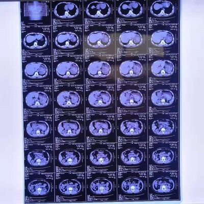 Film radiografici medici di costo ragionevole con elevata stabilità dell'immagine che forniscono immagini diagnostiche mediche chiare e precise