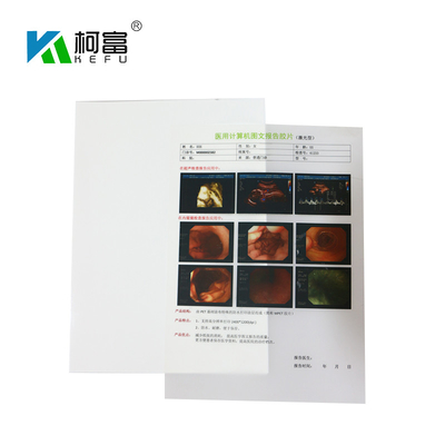 125 micron del getto di inchiostro X Ray Film A4 B5 16K di film bianco di stampa a getto di inchiostro