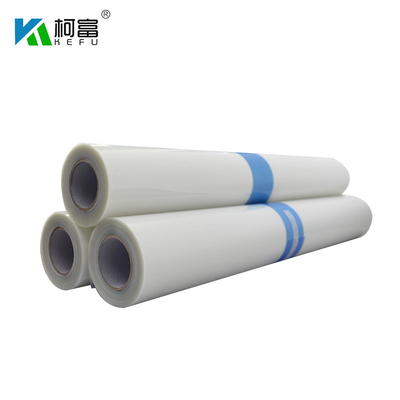 17&quot; film di stampa laser del toner dell'ANIMALE DOMESTICO del laser X Ray Film Rolls di bianco di X30m