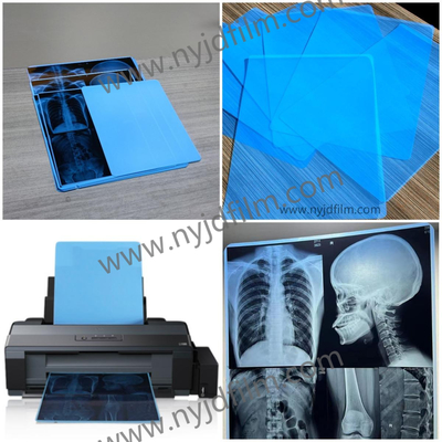 210 micron di film blu di X Ray Film Medical Inkjet Printing per l'ospedale