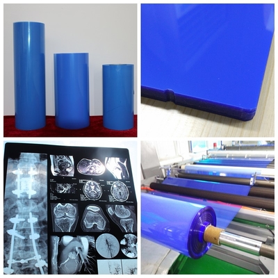 Film medico 11*14In di stampa a getto di inchiostro del film blu del getto di inchiostro ISO9001