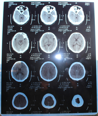 13x17 pollice Digital X Ray Film