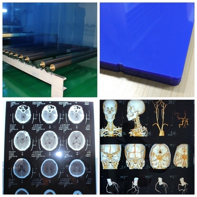 Film medico a 24 pollici di iso 9001 X 30m X Ray Film Blue Laser Transparency per gli ospedali