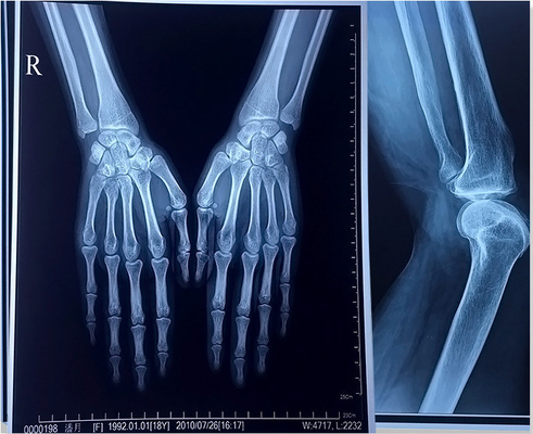 Film medico a 24 pollici di iso 9001 X 30m X Ray Film Blue Laser Transparency per gli ospedali