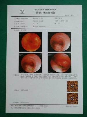 OEM bianco del getto di inchiostro X Ray Film del film asciutto medico di 125um basato ANIMALE DOMESTICO 150um 180um