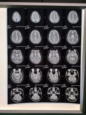 Anti 46&quot; statico film blu dell'ANIMALE DOMESTICO della lastra radioscopica medica di *30m per l'inchiostro a base d'acqua del pigmento della tintura