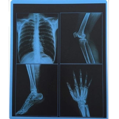 195 micron dell'ANIMALE DOMESTICO X Ray Film 10x12 di pollice di stampante blu del laser X Ray Film For Fuji OKI