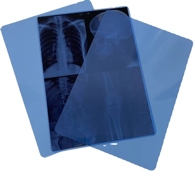 Film blu medico di stampa laser del toner di pollice dell'ANIMALE DOMESTICO X Ray Film 11x14 di radiologia dell'OEM