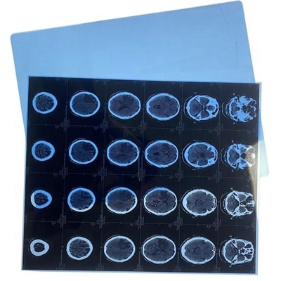 13x17 carta blu asciutta di pollice X Ray Medical Film Blue Transparency per la stampante a laser