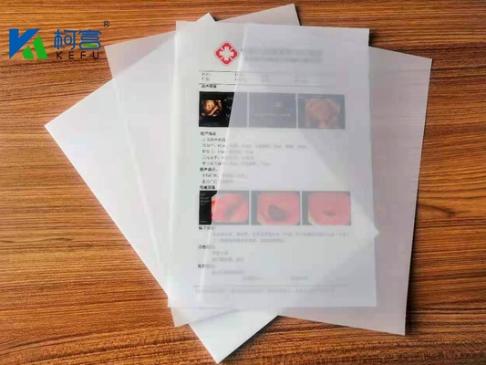 Film a raggi X laser stampato eccellente resistenza agli UV e buona resistenza all'umidità