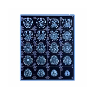 Film medico del getto di inchiostro dell'animale domestico di pollice del blu stampabile X Ray Film 11x14 del CE