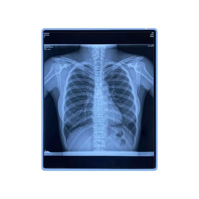 Film medico del getto di inchiostro dell'animale domestico di pollice del blu stampabile X Ray Film 11x14 del CE