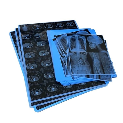 210 micron di 13X17 di pollice di ANIMALE DOMESTICO ad alto contrasto del film medico del getto di inchiostro X Ray Film