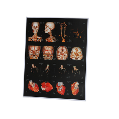 Getto di inchiostro X Ray Film dell'OEM 210um