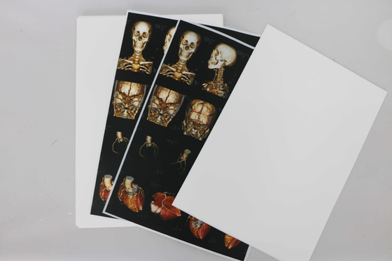 Pollice di ISO14001 Digital X Ray Film Medical X Ray Film 10x12