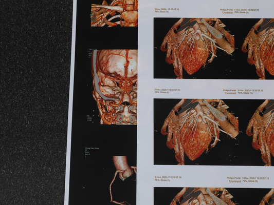 240gsm 180 film medico del petto del film 3D CT del getto di inchiostro del micron rispettoso dell'ambiente