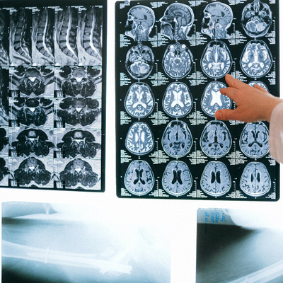 Film asciutto medicale a getto d'inchiostro blu Film a raggi X blu trasparente per apparecchiature radiologiche CT DR MRI