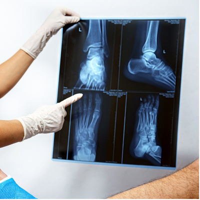 Resina A4 A3 pellicola medica a raggi X per grafica radiologica