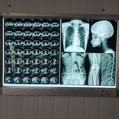 Resina A4 A3 pellicola medica a raggi X per grafica radiologica