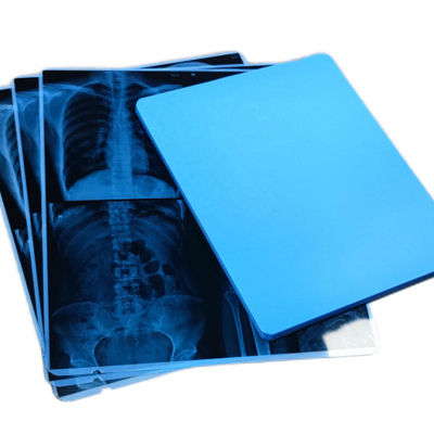 Pollice X Ray Dry Film And Screen della stampa 10x12 di Dicom per rappresentazione diagnostica