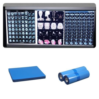 210microns base bianca bassa blu del getto di inchiostro X Ray Films For del Dott di pollice medico del CR 8x10