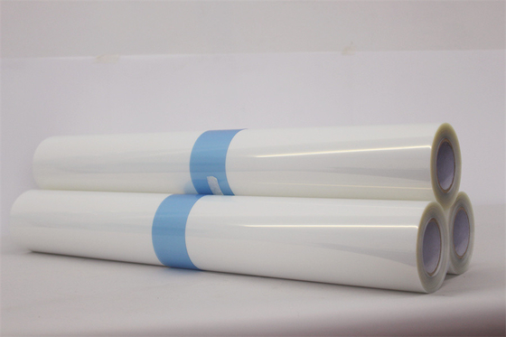 stampa a getto di inchiostro positiva 5mil 297mm x 420mm dei film lattei impermeabili della matrice per serigrafia 11x17
