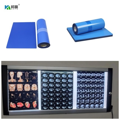 Il rotolo medico 8x10 14x17 A4 A3 100 del getto di inchiostro blu la X Ray Film 210 Micorn 10inch della base riveste