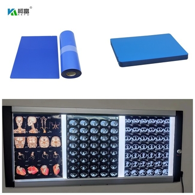 Il film 8x10 13x17 14x17 A4 A3 100 del getto di inchiostro X Ray Medical Blue Base Dry da 210 micron riveste