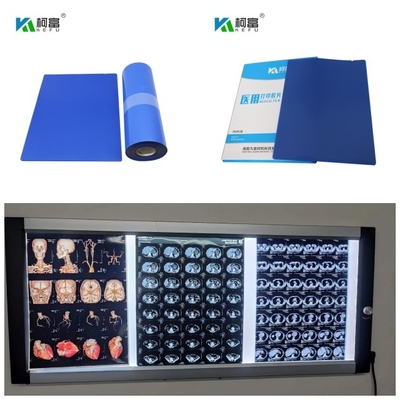 La tintura bassa blu medica di RMI del Dott CT del getto di inchiostro la X Ray Film inchiostrare 14inch X 125 strati rotola 10x12