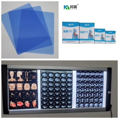 RMI X Ray del Dott asciutto CT del film del getto di inchiostro medico basso blu 210 micron di rotolo di 8x10 A4 A3 14inch