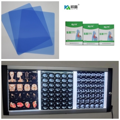 Getto di inchiostro medico X Ray Films di RMI del Dott CT 210 micron di rotolo basso blu dell'inchiostro 8x10 A4 A3 10inch