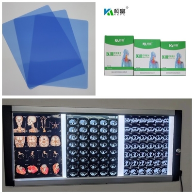 Uscita 280gsm X medica Ray Film Inkjet Blue Base per la risonanza magnetica 10x12 11x14 A4 A3 del Dott CT