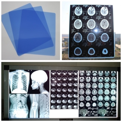 210um cassetta medica di RMI del Dott CT del getto di inchiostro X Ray Film Blue For Digital con gli strati 8x10