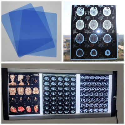 Film asciutto del getto di inchiostro medico basso blu per Digital X Ray Image With 210microns A3 13x17