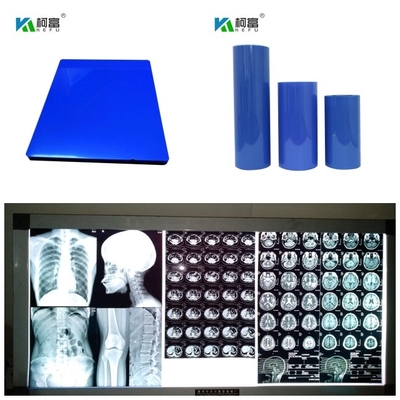 280gsm uscita asciutta medica di immagine di colore del getto di inchiostro X Ray Film Blue Base Digital
