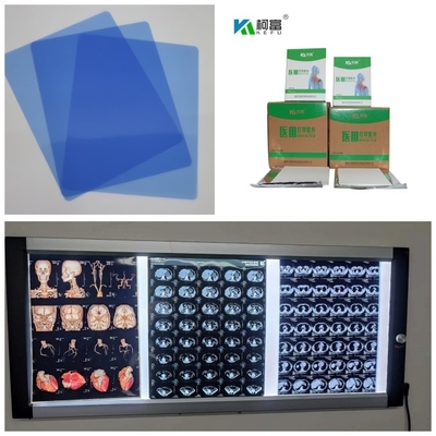 Getto di inchiostro medico X Ray Film Blue Base With 280gsm di Digital per 14x17inch A4 impermeabile