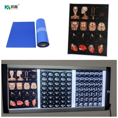 Getto di inchiostro medico basso blu X Ray Film For Digital Image 280gsm per l'immagine di colore 14x17inch