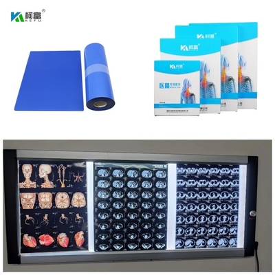 Base blu X Ray Film Digital Image With 210um del getto di inchiostro medico per 14x17inch