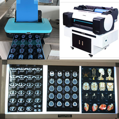 Getto di inchiostro medico X Ray Films di RMI del Dott CT 210 micron di rotolo basso blu dell'inchiostro 8x10 A4 A3 10inch