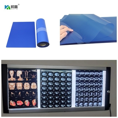 210microns il RMI del Dott medico del getto di inchiostro la X Ray Film For CT e la risonanza magnetica di 3D CT hanno prodotto 14x17